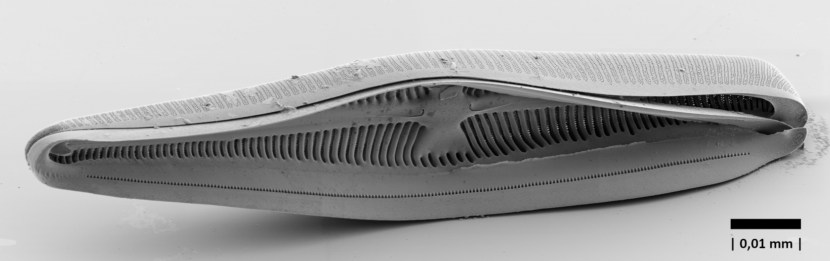 Rasterelektronenmikroskopische Abbildung einer präparierten Kieselschale von Gomphonella tegelensis mit Blick in das Innere einer Schachtelhälfte. Der schwarze Balken entspricht 10 µm (0,01 mm).  Foto: Oliver Skibbe, Juliane Bettig, Forschungsgruppe Diatomeen, Botanischer Garten u. Botanisches Museum Berlin, Freie Universität Berlin